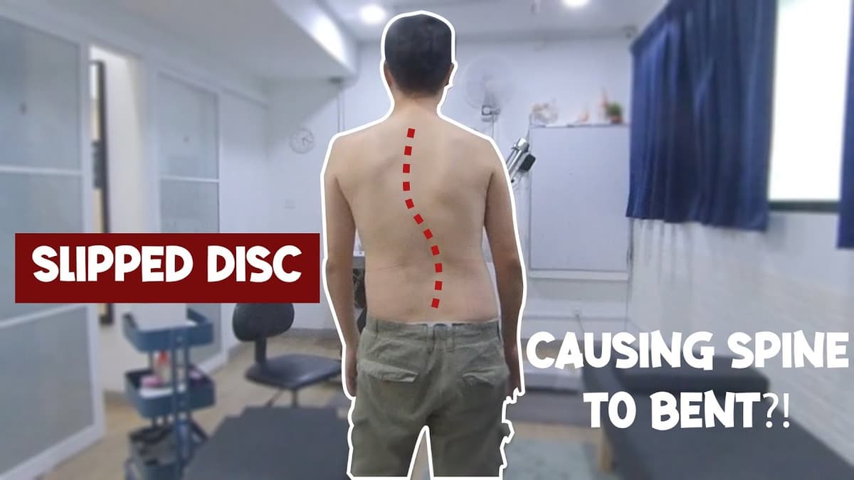 椎间盘突出——身体歪向一侧 — Bewell 脊椎治疗诊所 马来西亚